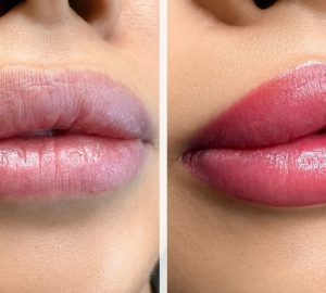 trucco permanente alle labbra