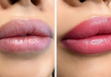 trucco permanente alle labbra