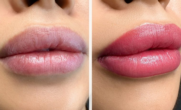 trucco permanente alle labbra